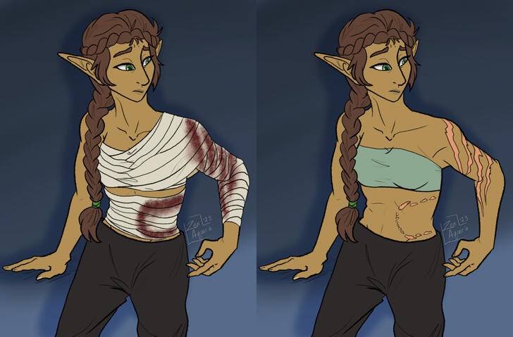 Auscives: Ysra New Scars